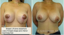 Breast Reconstruction - Patient O