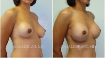 Breast Reconstruction - Patient B