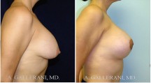 Breast Reconstruction - Patient K