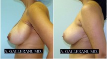 Breast Reconstruction - Patient D
